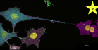Fluorescent microscopy image of five cells stained in distinct colors: three blue with yellow nuclei, one green, and one purple with two yellow nuclei. A long filament connects the blue and purple cells.